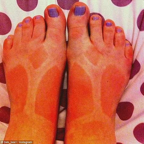 Tanning Fails Are Captured In Eye Watering Online Gallery Daily Mail