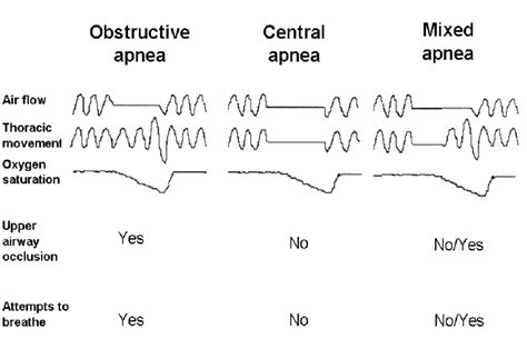 Obstructive Central And Mixed Apneas Download Scientific Diagram