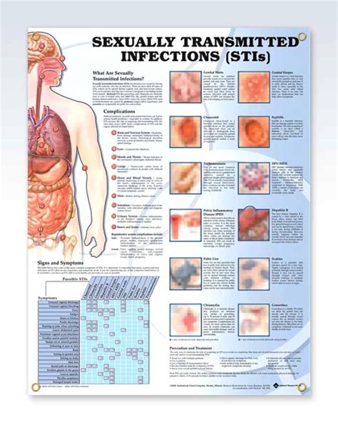 Sexually Transmitted Infections Anatomy Posters Clinicalposters