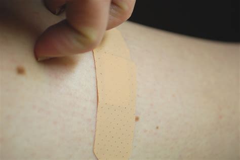 How To Treat A Latex Adhesive Allergic Skin Rash Ehow