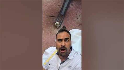 Dr Khaled Sadek Reacts Blackheadremoval Skincare Youtube