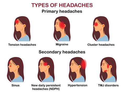 tipos de dolores de cabeza infografía vectorial 6891055 Vector en