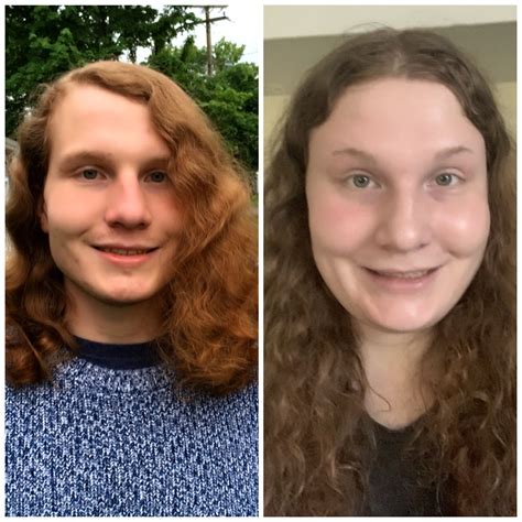 A Picture From 2 Years Ago Versus Today No Makeup 20 Months Hrt