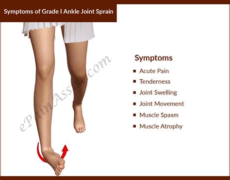 Ankle Sprain Symptoms Causes And Treatment Healthncur