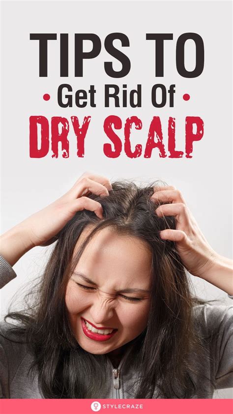 10 Best Home Remedies To Get Rid Of Dry Scalp In 2020 Dry Scalp Dry Scalp Remedy Dry Scalp
