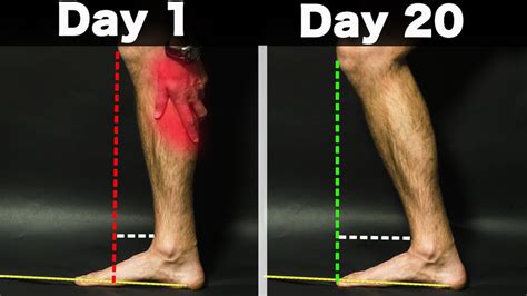 The Only Thing You Need To Fix Tight Calves YouTube