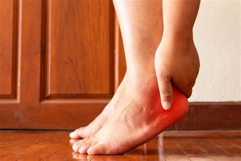 Why Does Plantar Fasciitis Hurt So Much Uhealth Collective