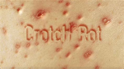 Crotch Rot 2008 YouTube