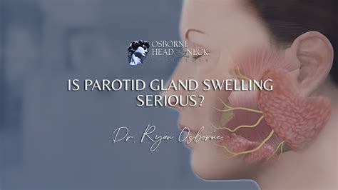 Is Parotid Gland Swelling Serious Youtube