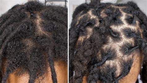 3 Months Of New Growth Hair Retwist Braided Technique No Clips No