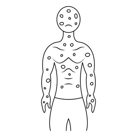 80 Smallpox Scars Stock Photos Pictures And Royalty Free Images Istock