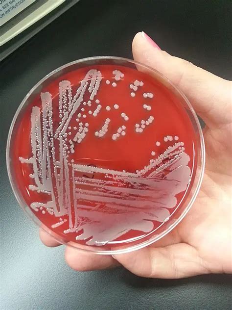 Staphylococcus Aureus Blood Agar Plate