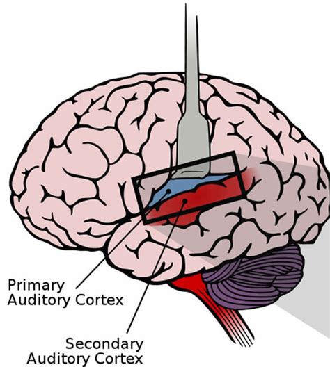 The Auditory Cortex Of Hearing And Deaf People Are Almost Identical
