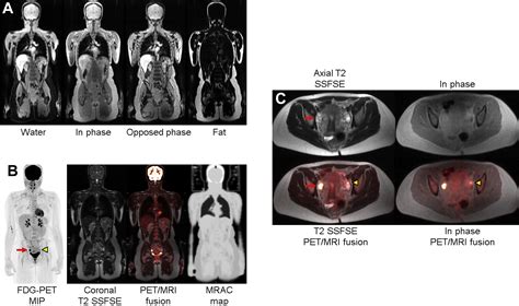 Clinical Applications Of Petmr Imaging Radiology Key