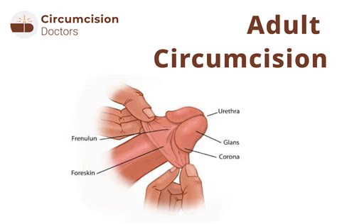 Circumcised