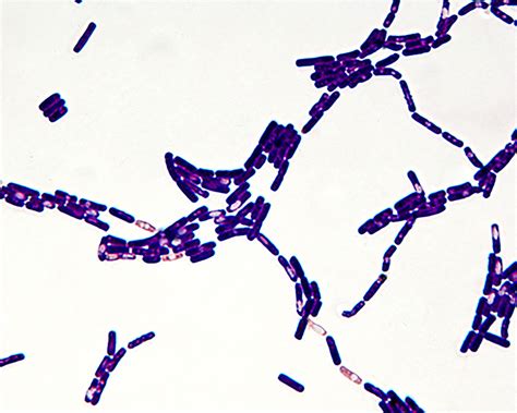Bacillus Species Gram Stain Etsy The Best Porn Website