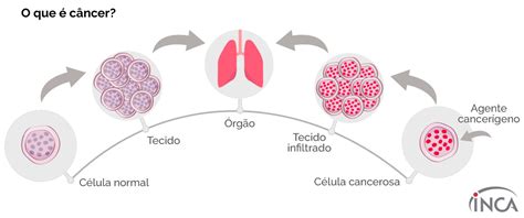 O Que é Câncer — Instituto Nacional De Câncer Inca