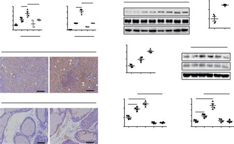 depression activated il6 stat3 signaling in prostate cancer cells a download scientific