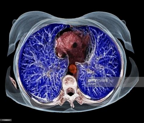 Chest Anatomy 3d Ct Scan High Res Stock Photo Getty Images