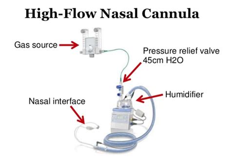 Tidal ventilation was obtained using respiratory vapotherm delivers higher flow rates with increased comfort to the patient.4 although there are some published reports of vapo use in adults, few studies. emDOCs.net - Emergency Medicine Educationpulmonary ...