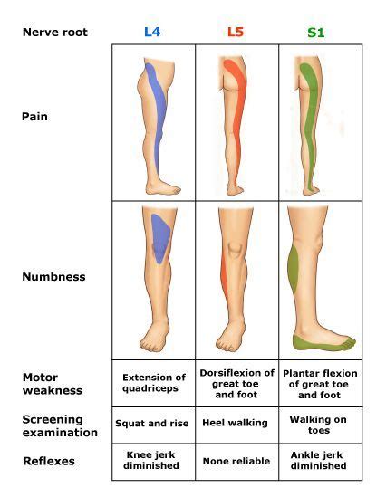 Nerves In Low Back Testing For Nerve Root Compression In The Low Back