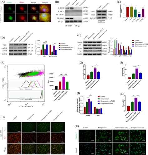 G3bp1tsc2 Complex Regulated The Mtor Signalling And The Lysophagy