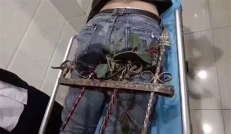 Man Gruesomely Impaled After Falling Bum First Onto Spiked Railings Extraie