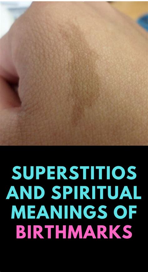 Birthmarks Spiritual Meanings Superstitions Artofit