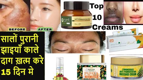 Top 10 Cream For Pigmentation On Face Cream For Blemishes And Dark Spots