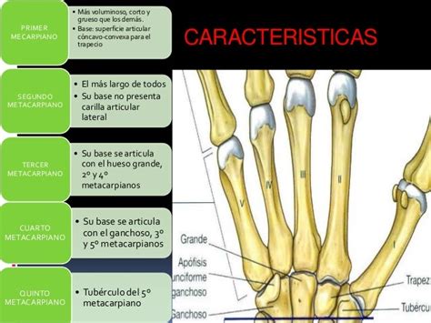 Presentación Metacarpianos