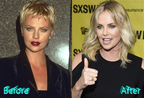 Charlize Theron Plastic Surgery Before And After Nose Vrogue Co