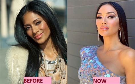 Nicole Scherzingers Plastic Surgery Before And After Photos