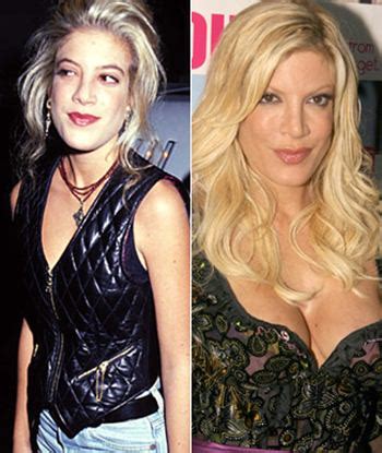 Tori Spelling Plastic Surgery Gone Wrong Before And After Plastic Surgery Hits