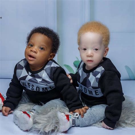 Dünyanın En İlginç İkizlerine Merhaba Diyelim Dergi Kafası Beautiful