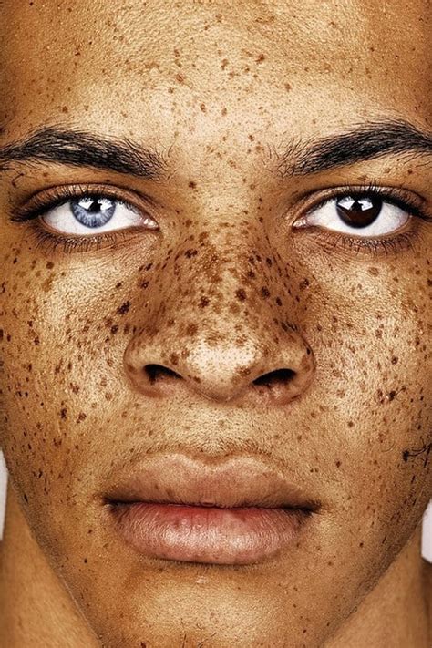 Photos Of People With Freckles Popsugar Beauty Photo 7