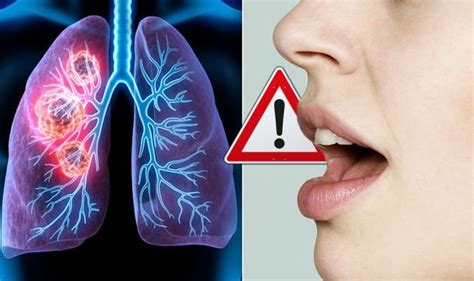 Lung Cancer Symptoms Signs Of A Tumour Include Voice Changes And A