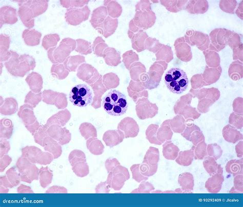 Neutrophils Blood Smear Is Often Used As A Follow Up Test To Ab