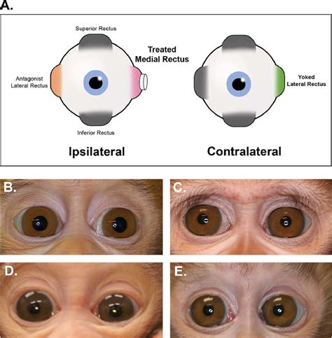 A Rectus Extraocular Muscles And The Experimental Design