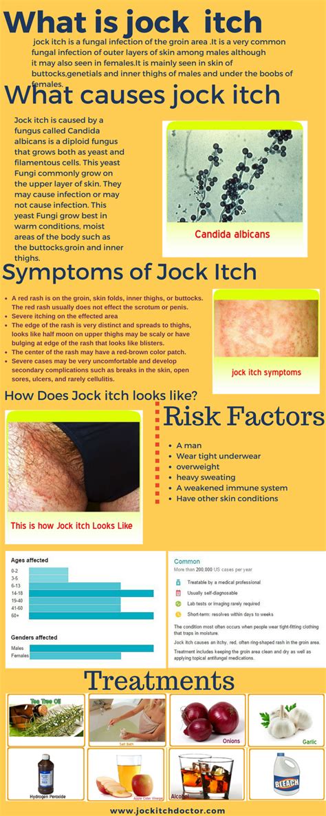 Jock Itch Causessymptomstreatmentandprevention Visually