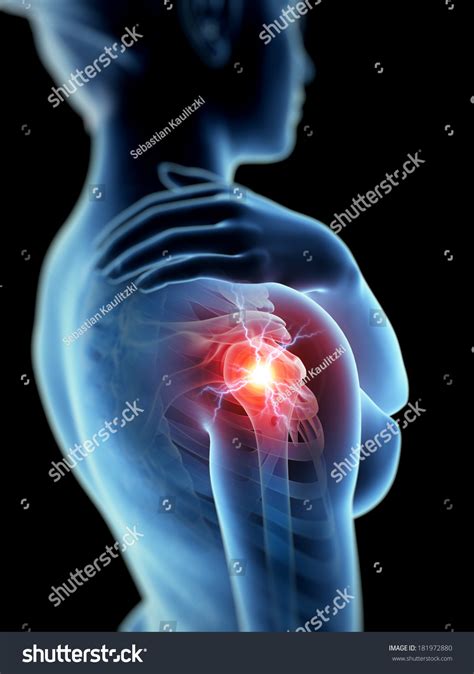 A Woman Having Acute Pain In The Shoulder Joint Stock Photo 181972880