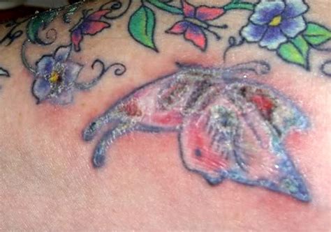 Infected Tattoos Causes Symptoms And Treatment Authoritytattoo