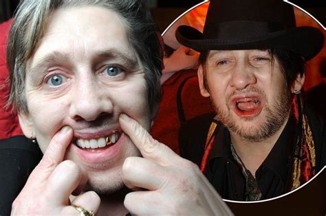 Pogues Frontman Shane Macgowan Unveils New Teeth After Undergoing