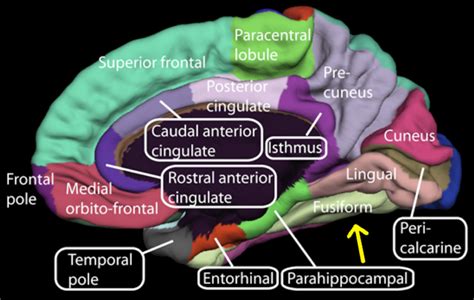 The Fusiform Face Area Of The Brain Processes Face Perceptions