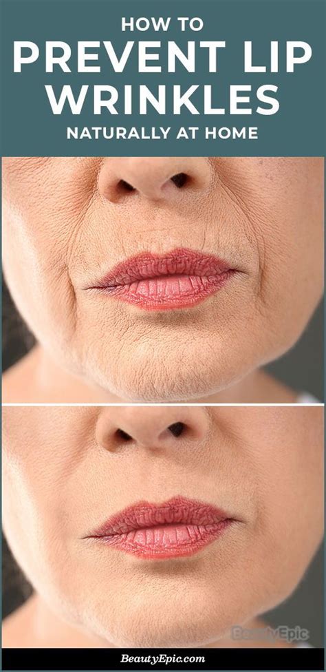 How To Get Rid Of Wrinkles On Lips Naturally Lip Wrinkles How To