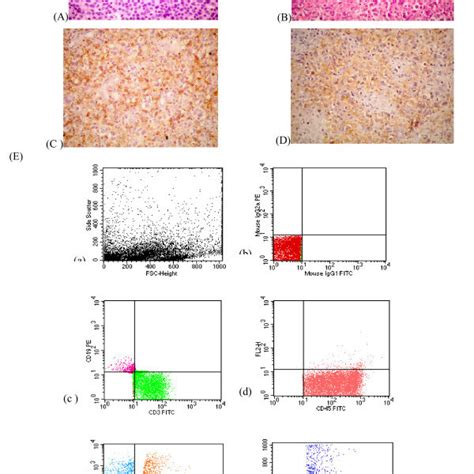 A Touch Imprint Of Dlbcl Case Showing Large Atypical Lymphoid Cells