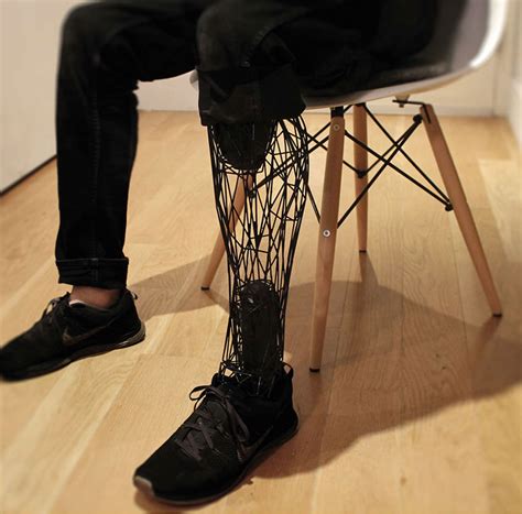 Exo D Printed Prosthetic Limbs By William Root Homeli