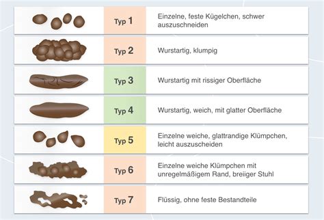 Verstopfung Obstipation Ursachen Symptome And Was Hilft
