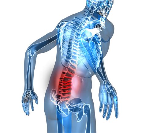 Neurophysiological Pain Education For Patients With Chronic Low Back