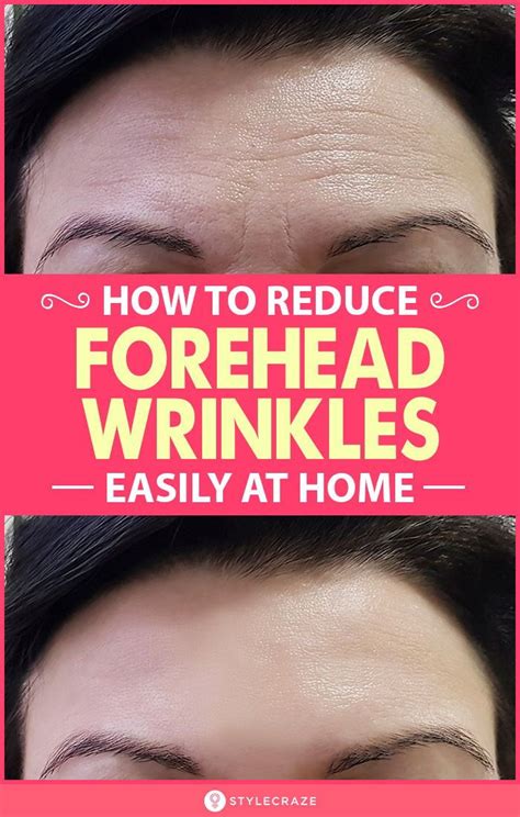 This cool pink long pixie with the layers and longer feathered bangs to cover and hide forehead wrinkles will take away the numbers from your age! How To Get Rid Of Forehead Wrinkles: 10 Home Remedies in ...