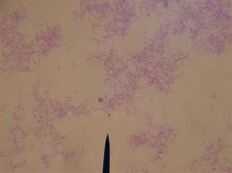 Rhodospirillum rubrum are bacteria, meaning that they are prokaryotes. File:Botony Exam 1 004.JPG - Wikimedia Commons